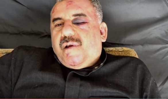 Боевики опубликовали новое видео избитого пилота Су-22 ВВС Сирии (ВИДЕО) | Русская весна