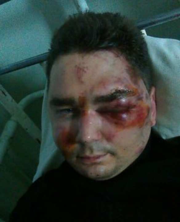 В Киеве накануне Пасхи, «Правый сектор» жестоко избил руководителя «Союза верных казаков» Алексея Селиванова | Русская весна