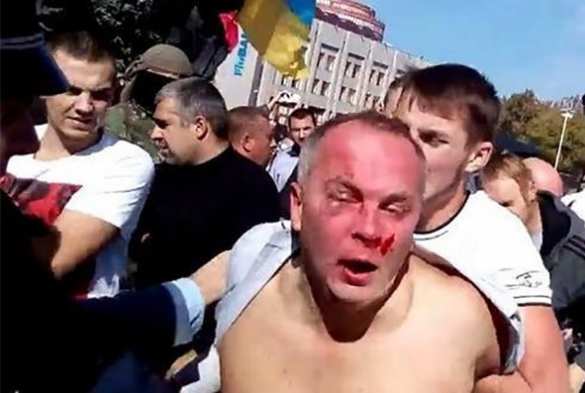 Избитый боевиками «Правого сектора» Нардеп Шуфрич вернется в Одессу | Русская весна