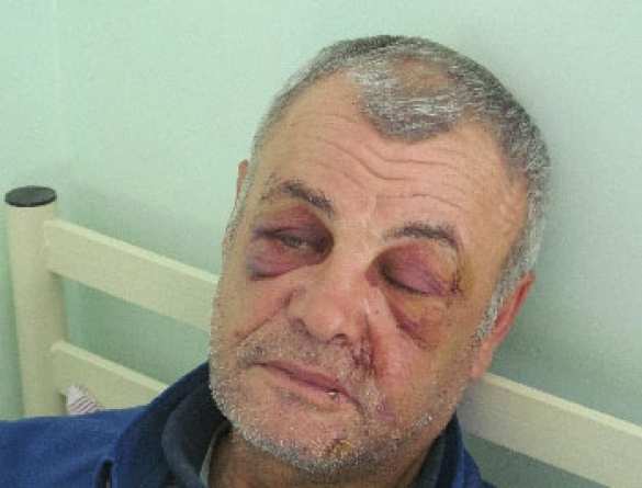 В запорожском селе жители избили односельчанина, пошедшего в каратели | Русская весна