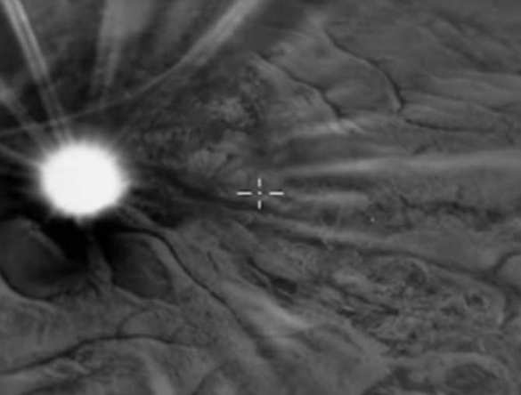 Уничтожение авиударами ВКС РФ командиров террористов и опорного пункта боевиков (ВИДЕО) | Русская весна